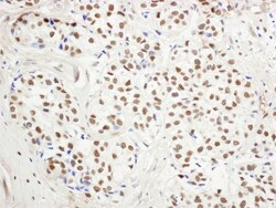 LSD1 Antibody, Novus Biologicals 0.1mg; Unlabeled:Antibodies, Polyclonal